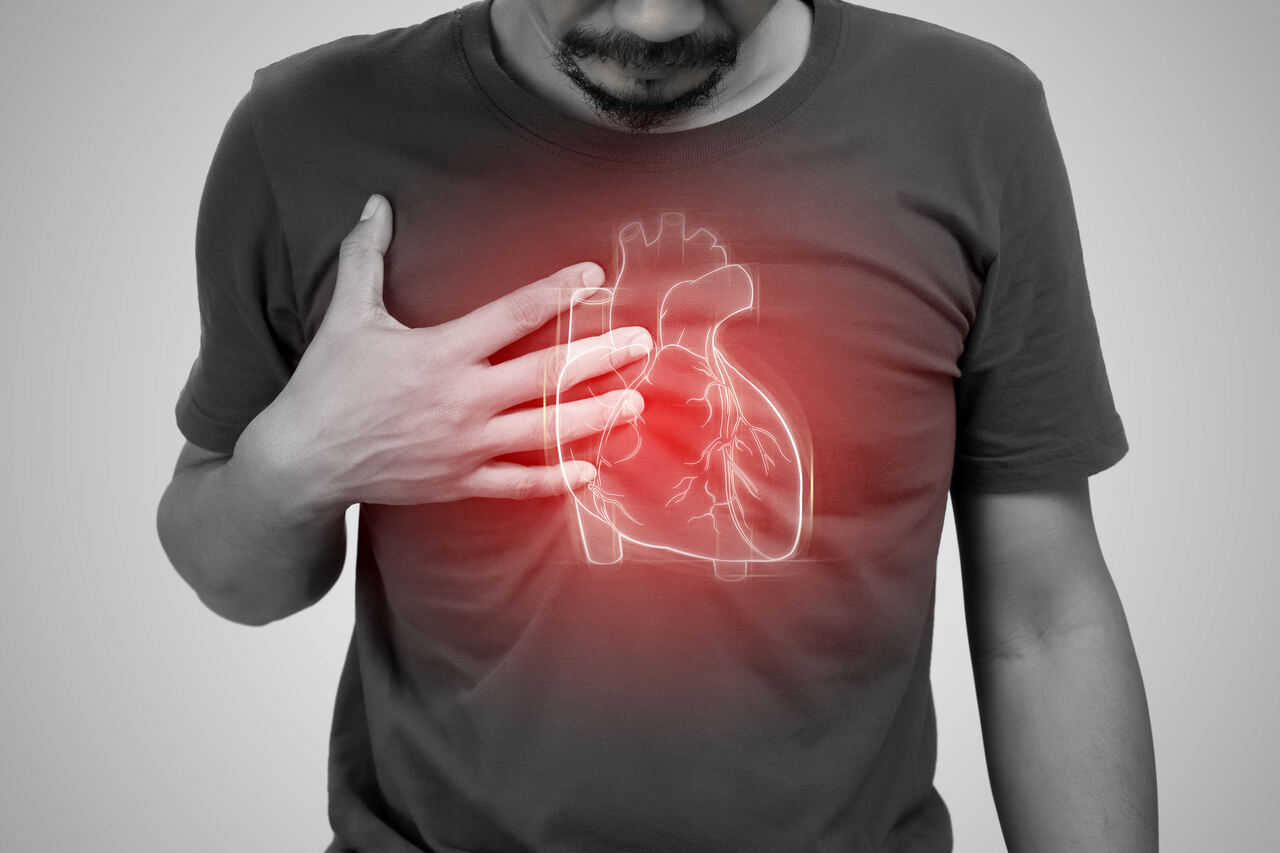 Infarto-Cirurgia cardíaca goiania