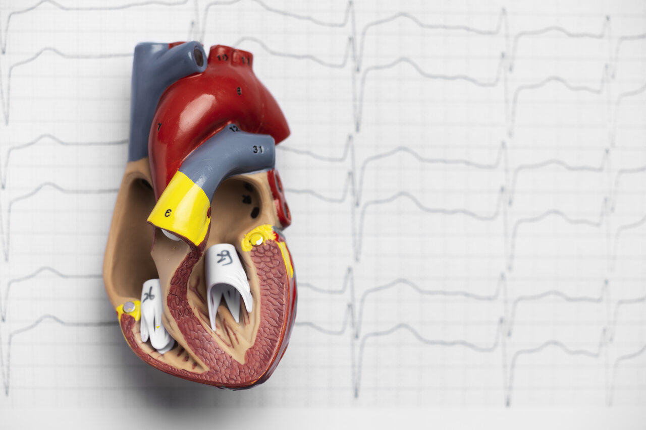 Valvoplastia