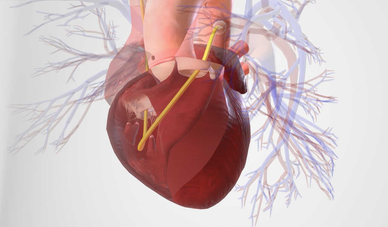 Ponte de safena ou cirurgia de revascularização você sabe para que serve