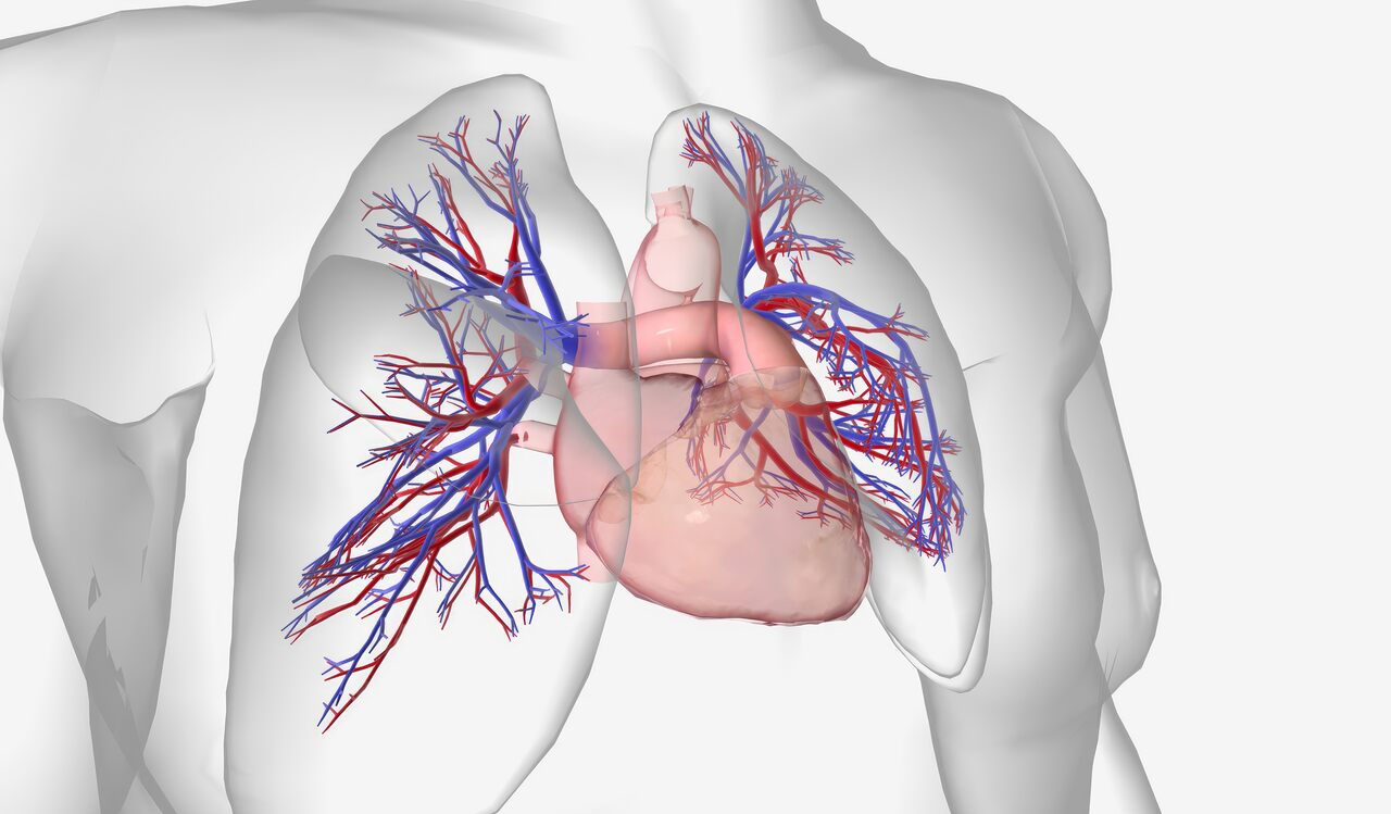 Atresia pulmonar