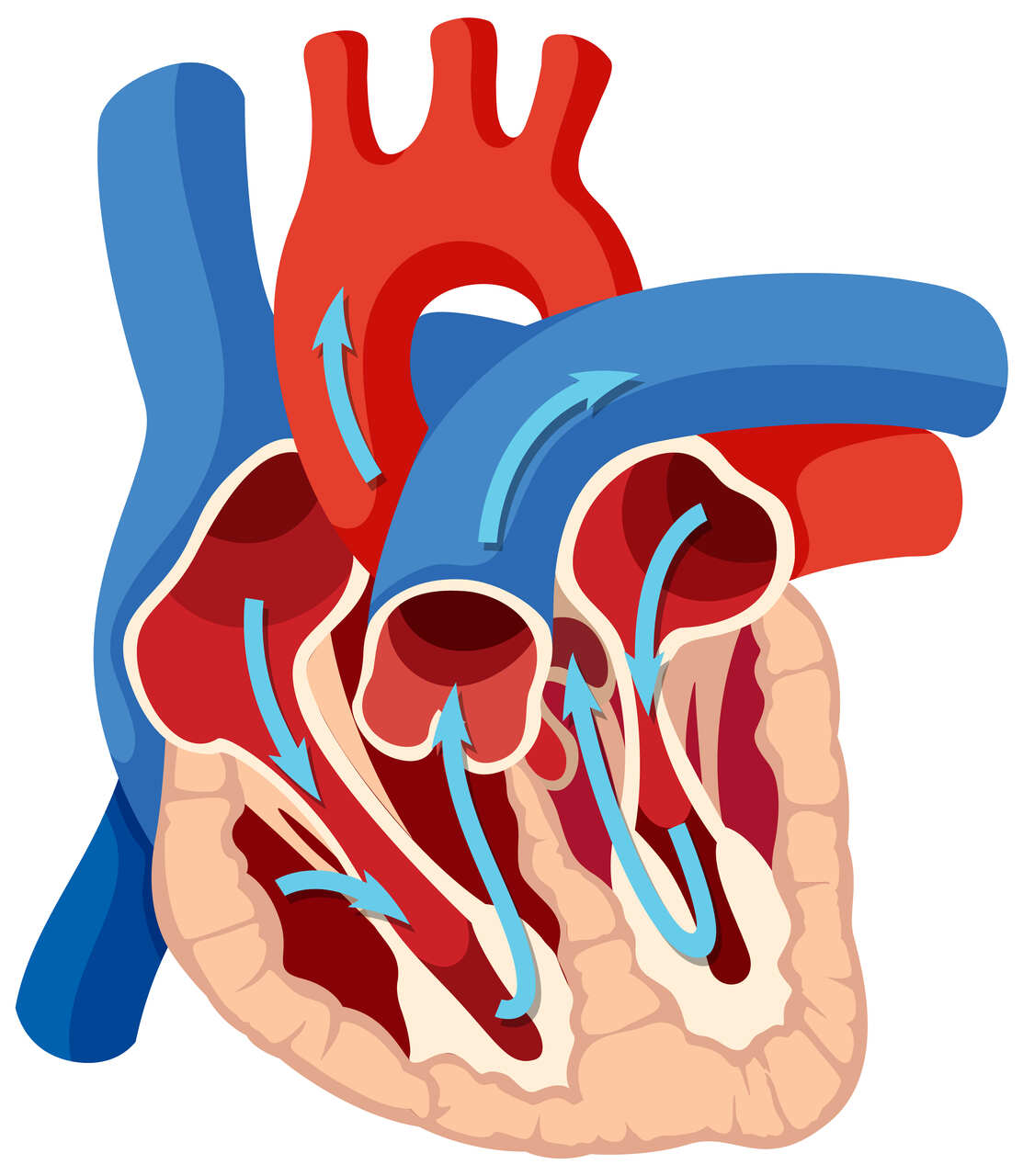 Cirurgias de aorta