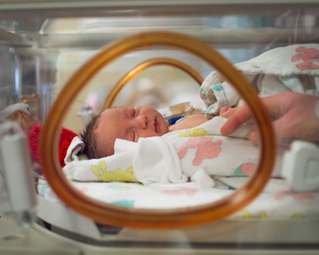 Cirurgias cardíacas em recém-nascidos inovação no uso da CEC e perfusão neonatal