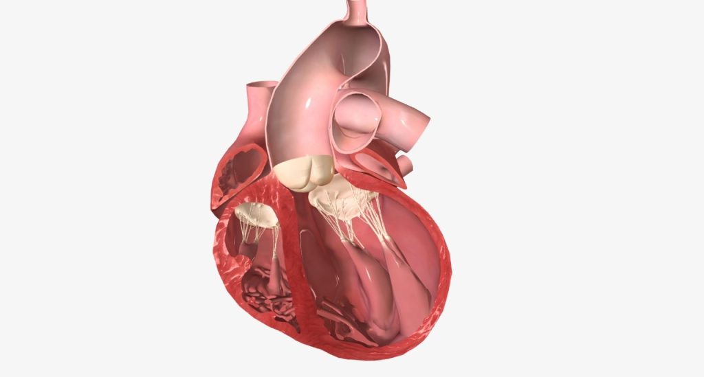 Prolapso da válvula mitral quando o reparo é melhor que a troca