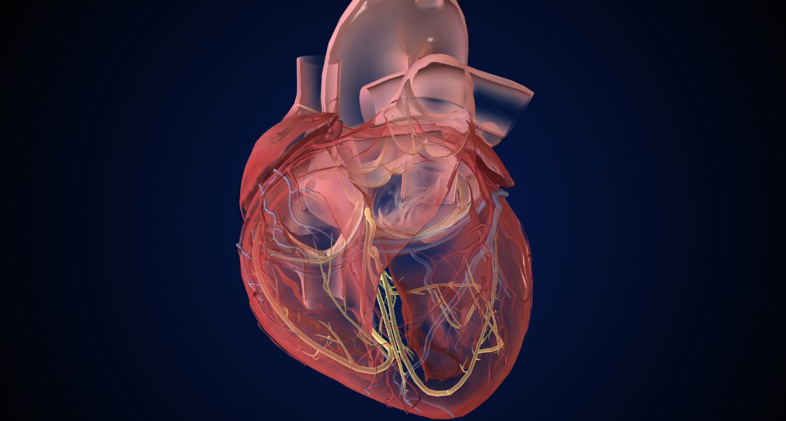 Por que enxertos arteriais são o futuro da revascularização miocárdica