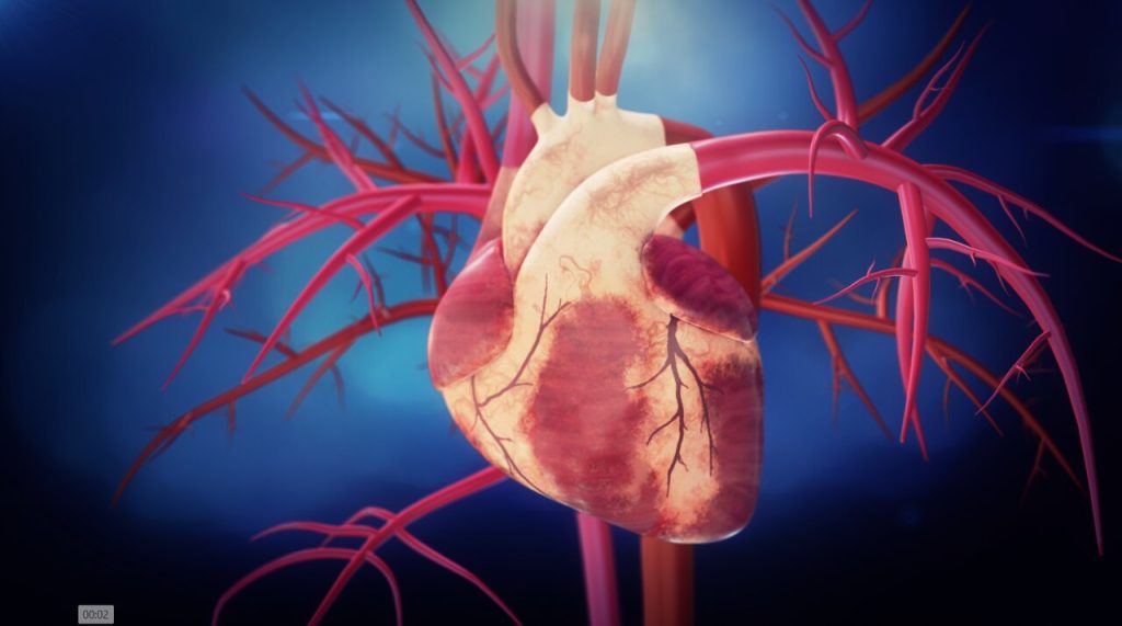 Revascularização personalizada por que enxertos arteriais múltiplos aumentam a sobrevida